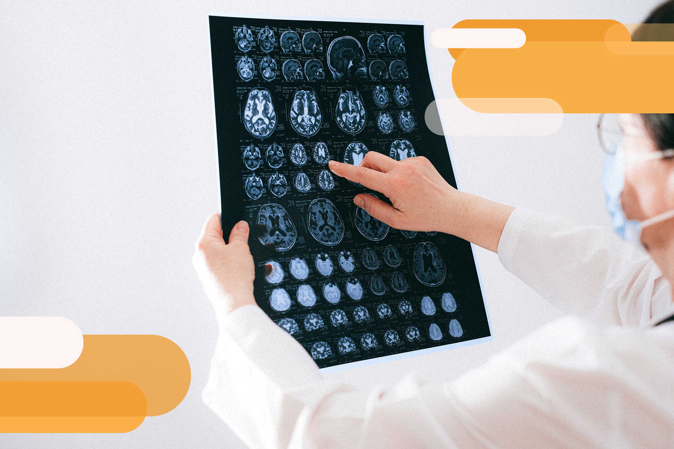 MS doctor checking MRI scan