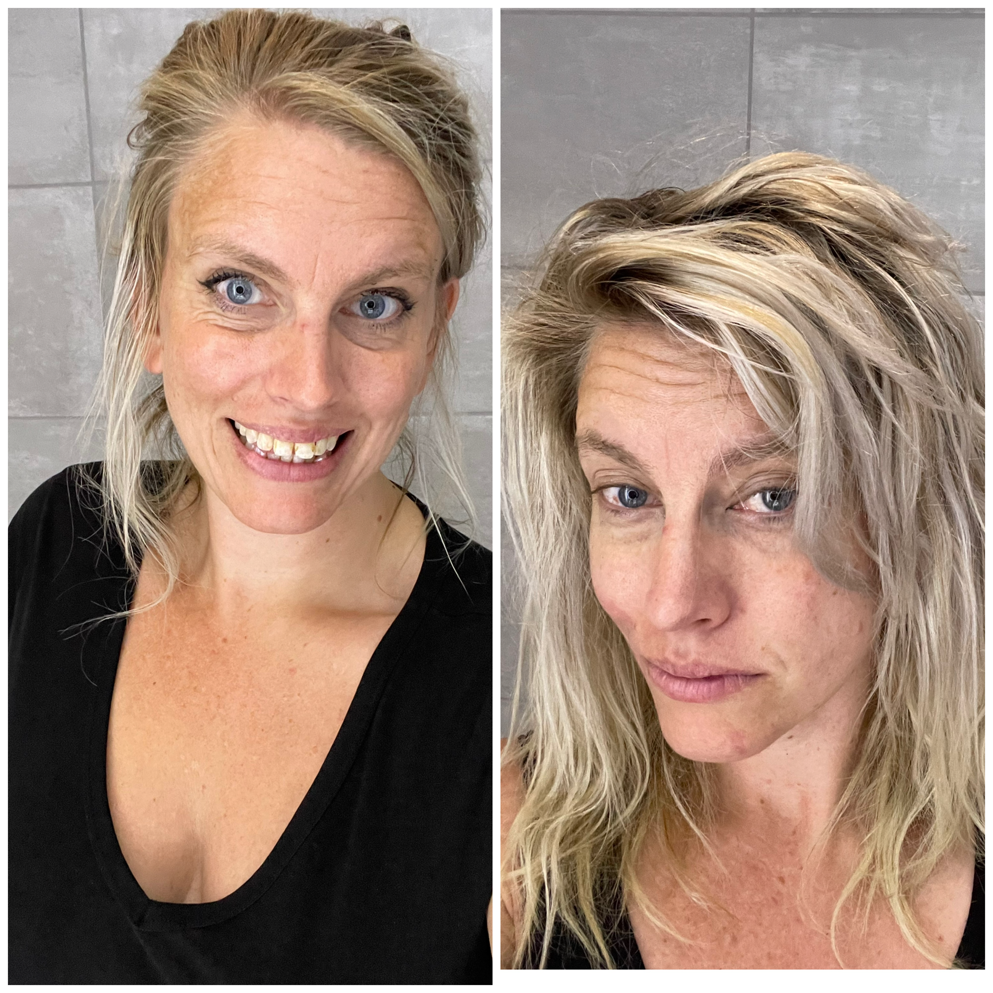 Hur ser man ut när man är sjuk