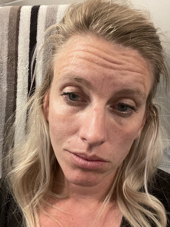 Linda bloggar om MS
