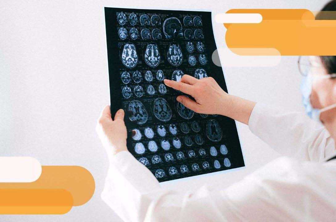 MS doctor checking MRI scan