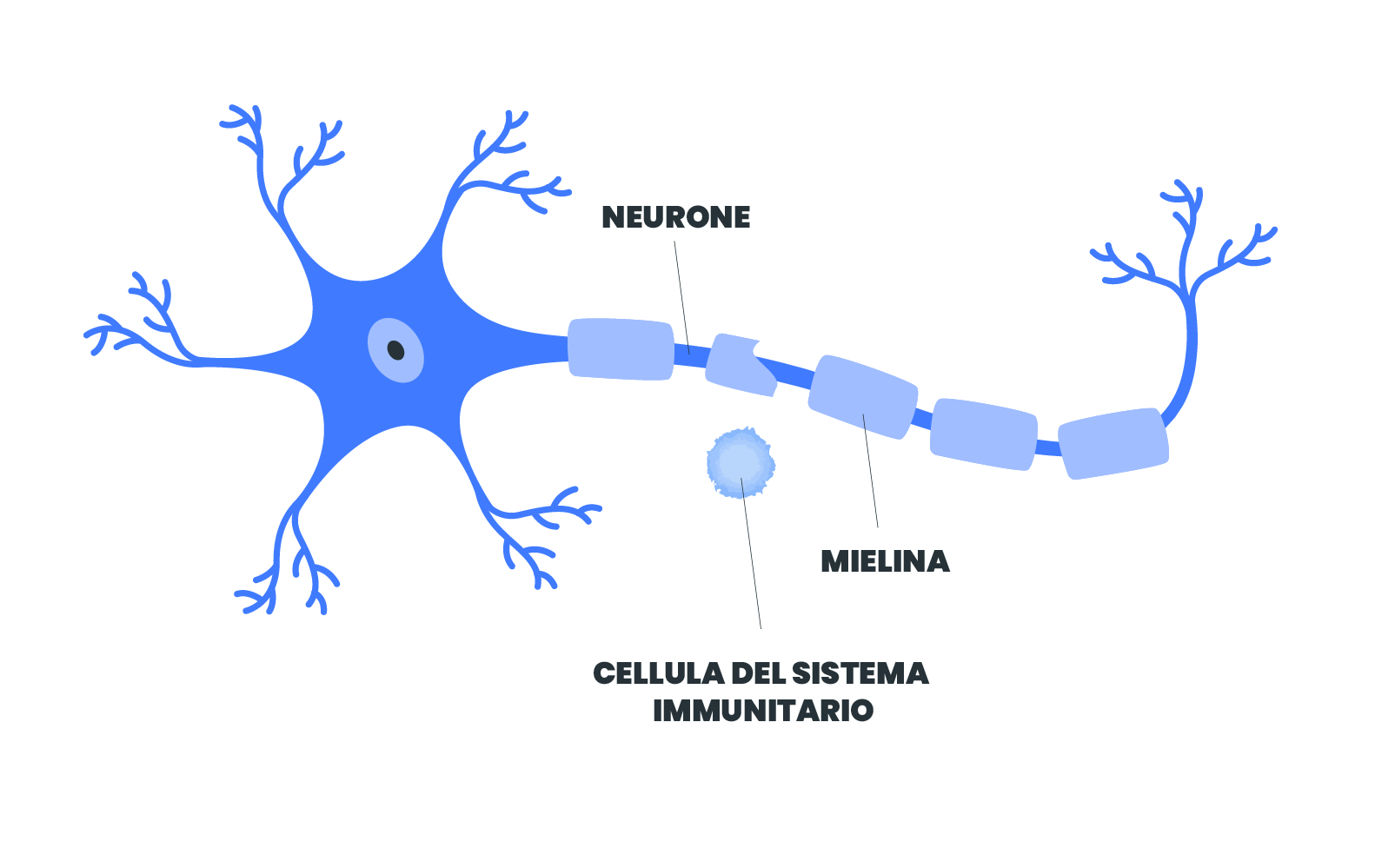 sclerosi-multipla-immagini-sito_2