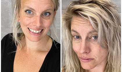 Hur ser man ut när man är sjuk?