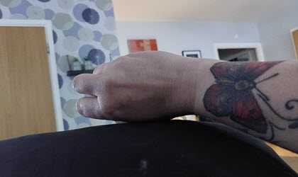 Caroline om kramper.