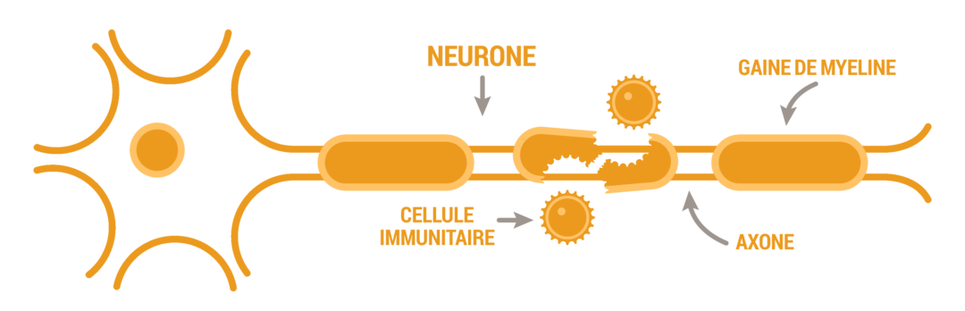 Sep-Sp-schema 1