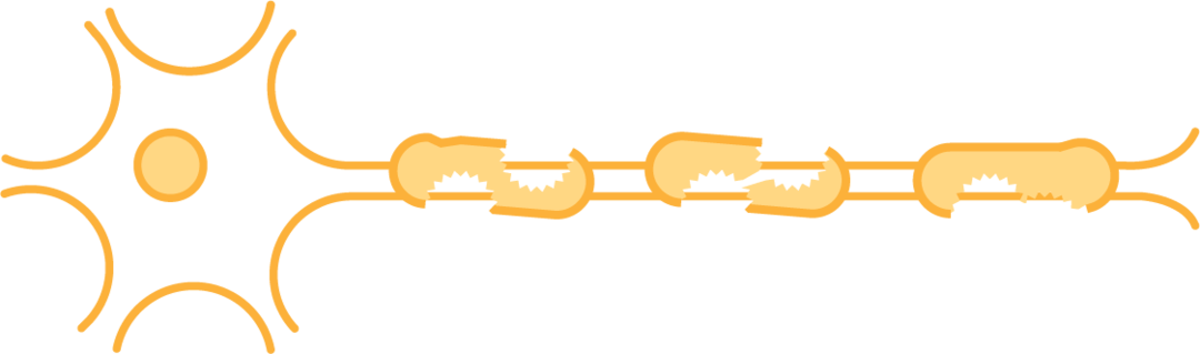 Myelinlagret kan tunnas ut och nervtrådarna blir mer sårbara.