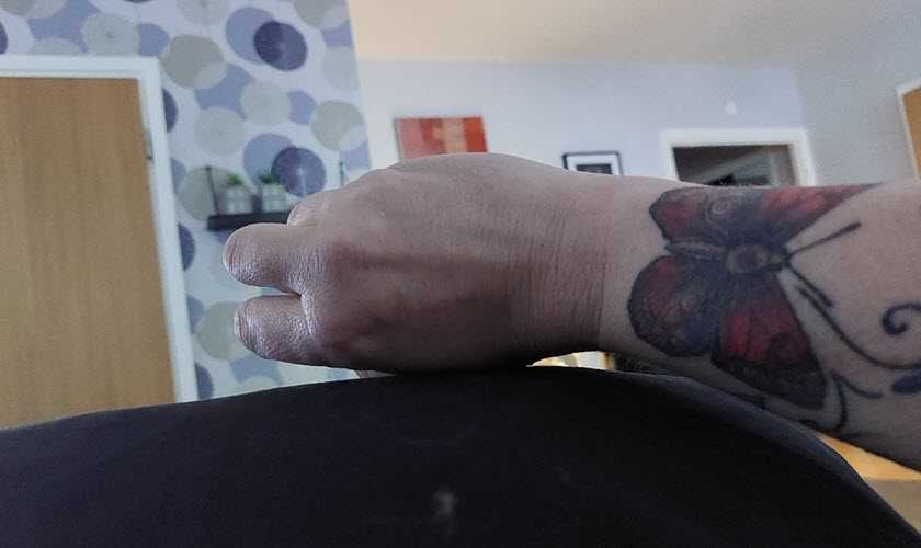 Caroline skriver om kramper vid multipel skleros (MS).